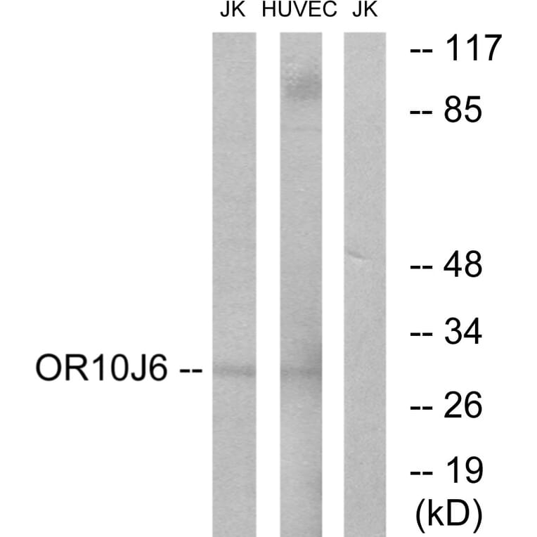 Western Blot - Anti-OR10J6 Antibody (G422) - Antibodies.com