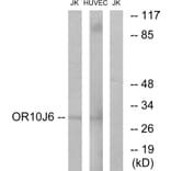 Western Blot - Anti-OR10J6 Antibody (G422) - Antibodies.com