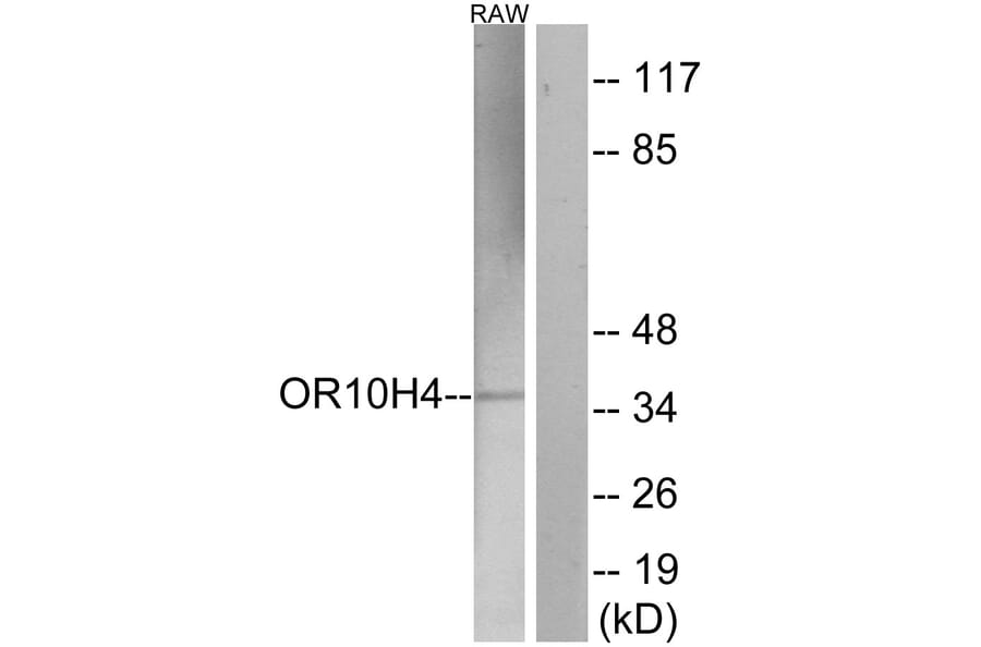 Western Blot - Anti-OR10H4 Antibody (G501) - Antibodies.com