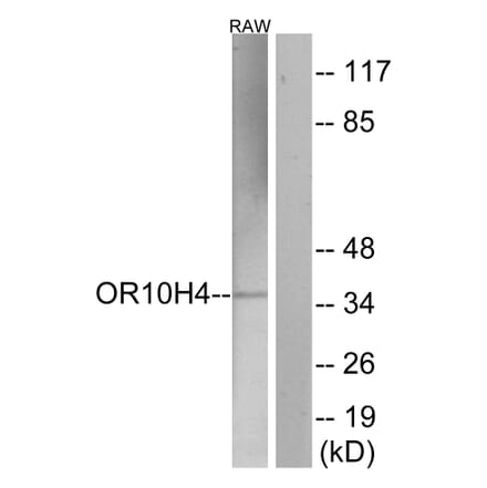 Western Blot - Anti-OR10H4 Antibody (G501) - Antibodies.com