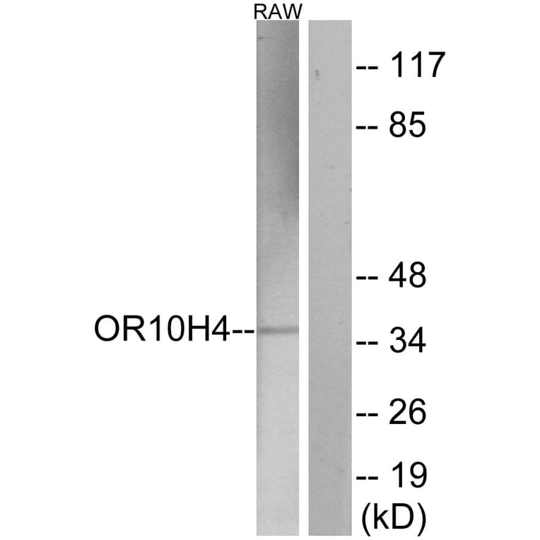 Western Blot - Anti-OR10H4 Antibody (G501) - Antibodies.com