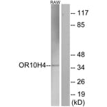 Western Blot - Anti-OR10H4 Antibody (G501) - Antibodies.com