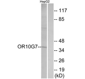 Western Blot - Anti-OR10G7 Antibody (G825) - Antibodies.com