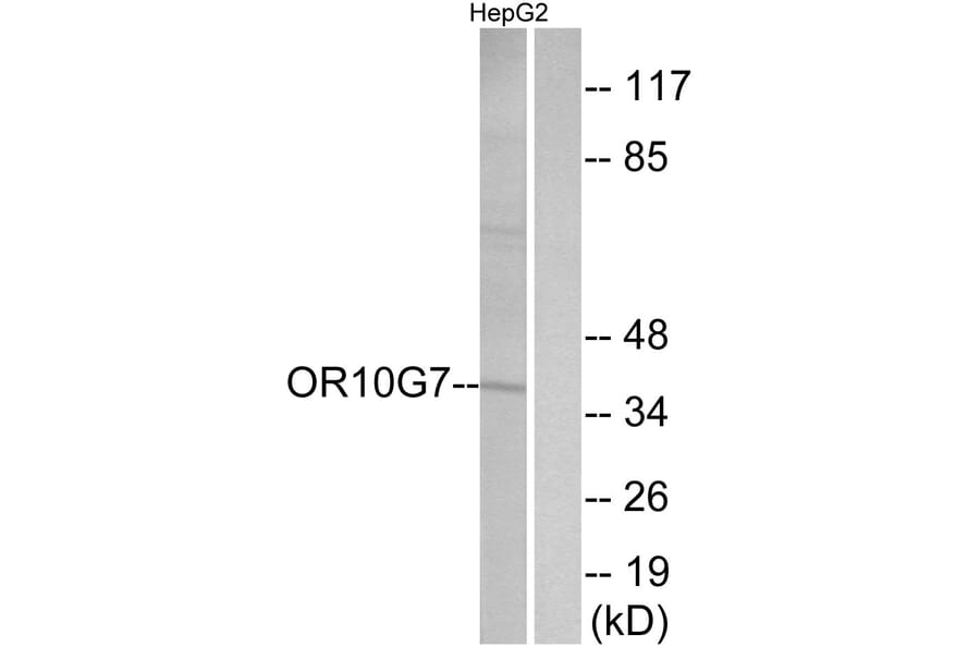 Western Blot - Anti-OR10G7 Antibody (G825) - Antibodies.com