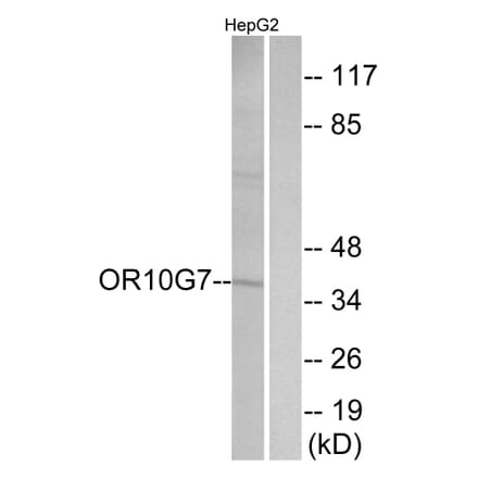 Western Blot - Anti-OR10G7 Antibody (G825) - Antibodies.com