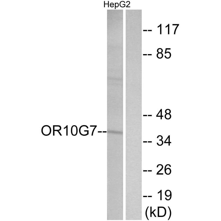 Western Blot - Anti-OR10G7 Antibody (G825) - Antibodies.com