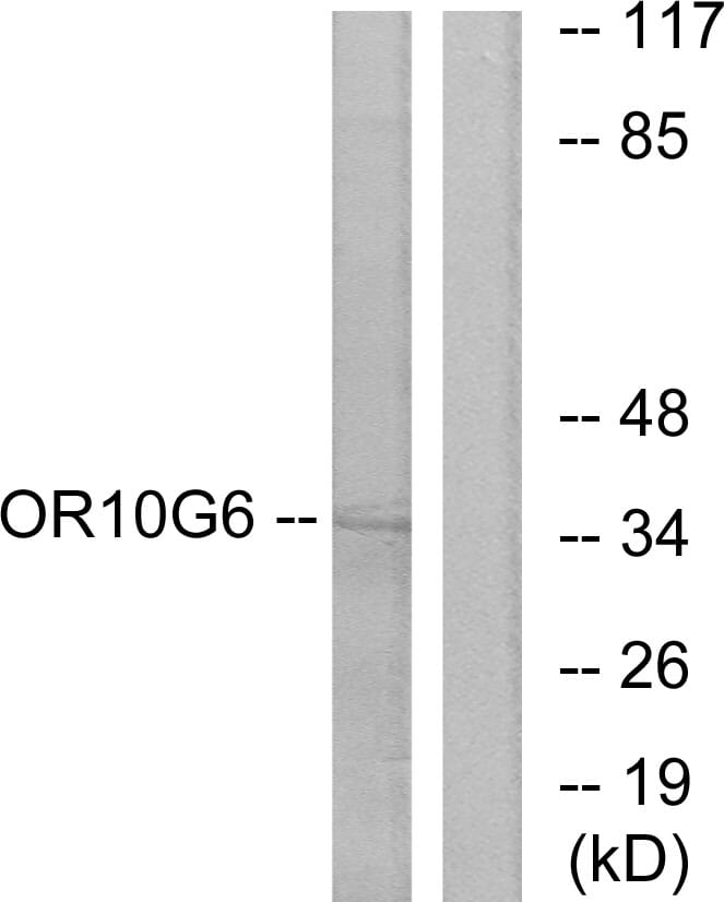 Western blot analysis of lysates from COLO cells using Anti-OR10G6 Antibody. The right hand lane represents a negative control, where the antibody is blocked by the immunising peptide.
