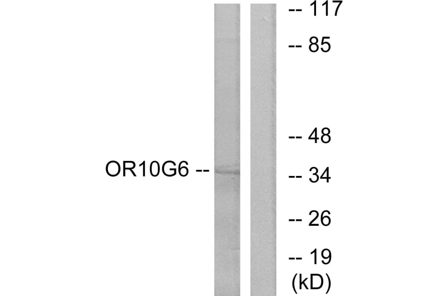 Western Blot - Anti-OR10G6 Antibody (G499) - Antibodies.com