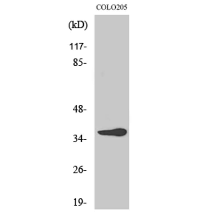 Western Blot - Anti-OR10G6 Antibody (G499) - Antibodies.com