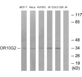 Western Blot - Anti-OR10G2 Antibody (G419) - Antibodies.com