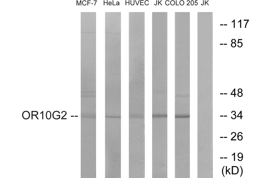 Western Blot - Anti-OR10G2 Antibody (G419) - Antibodies.com