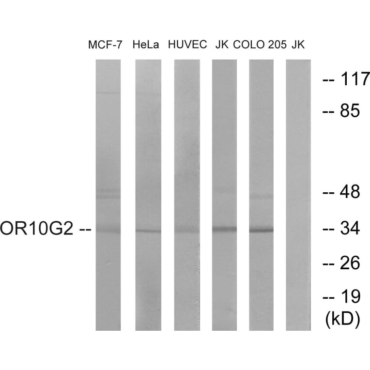 Western Blot - Anti-OR10G2 Antibody (G419) - Antibodies.com