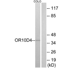 Western Blot - Anti-OR10D4 Antibody (G498) - Antibodies.com