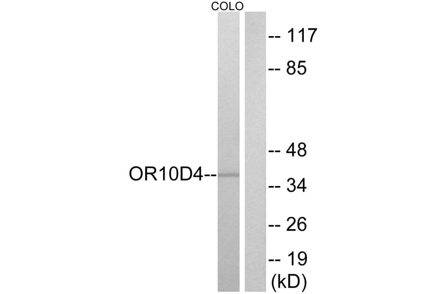 Western Blot - Anti-OR10D4 Antibody (G498) - Antibodies.com