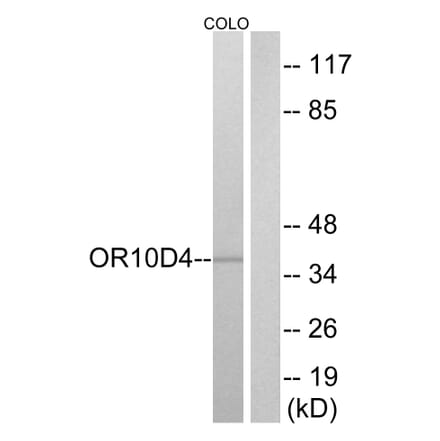 Western Blot - Anti-OR10D4 Antibody (G498) - Antibodies.com
