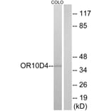 Western Blot - Anti-OR10D4 Antibody (G498) - Antibodies.com