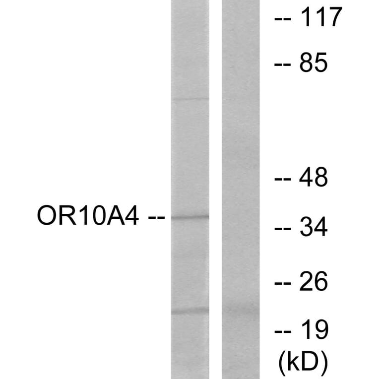 Western Blot - Anti-OR10A4 Antibody (G415) - Antibodies.com