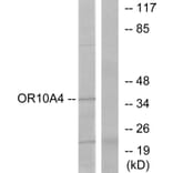 Western Blot - Anti-OR10A4 Antibody (G415) - Antibodies.com