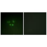 Immunofluorescence - Anti-Nibrin Antibody (B1221) - Antibodies.com