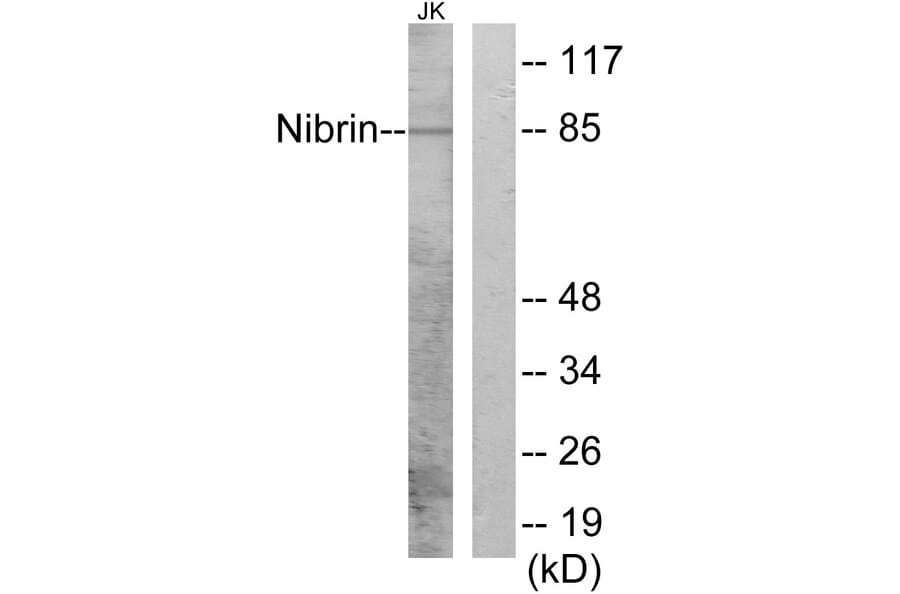 Western Blot - Anti-Nibrin Antibody (B1221) - Antibodies.com