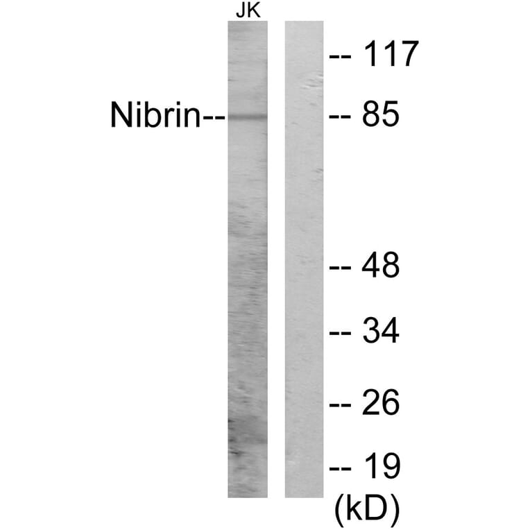 Western Blot - Anti-Nibrin Antibody (B1221) - Antibodies.com