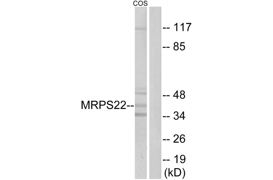 Western Blot - Anti-MRPS22 Antibody (C16654) - Antibodies.com