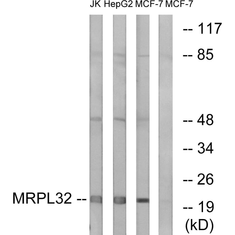 Western Blot - Anti-MRPL32 Antibody (C14071) - Antibodies.com