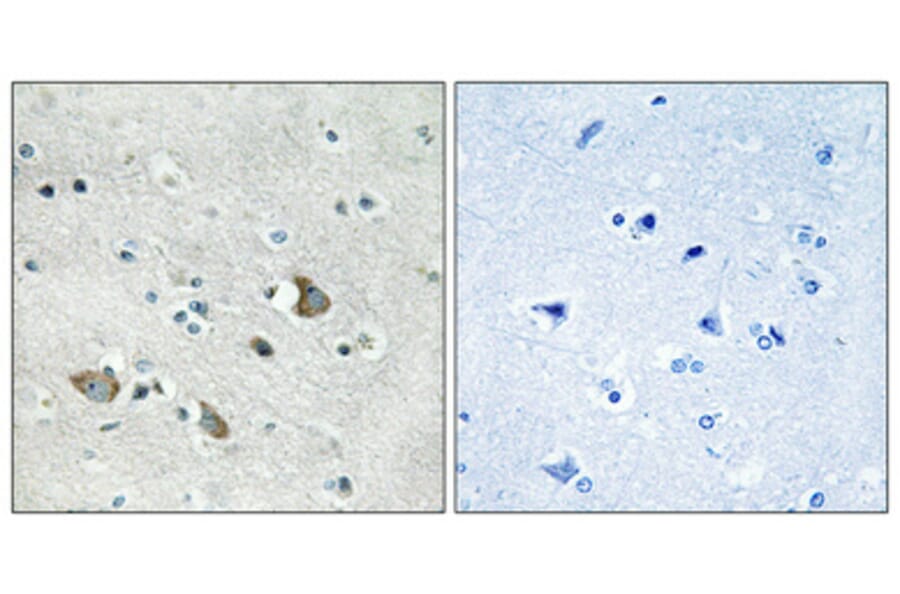 Immunohistochemistry - Anti-MRPL32 Antibody (C14071) - Antibodies.com