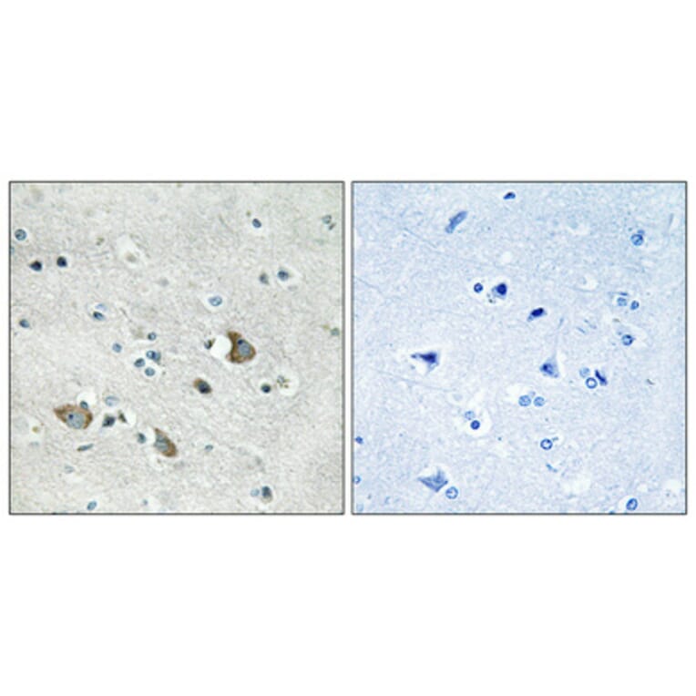 Immunohistochemistry - Anti-MRPL32 Antibody (C14071) - Antibodies.com