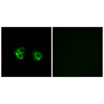 Immunofluorescence - Anti-MARCH2 Antibody (C15547) - Antibodies.com