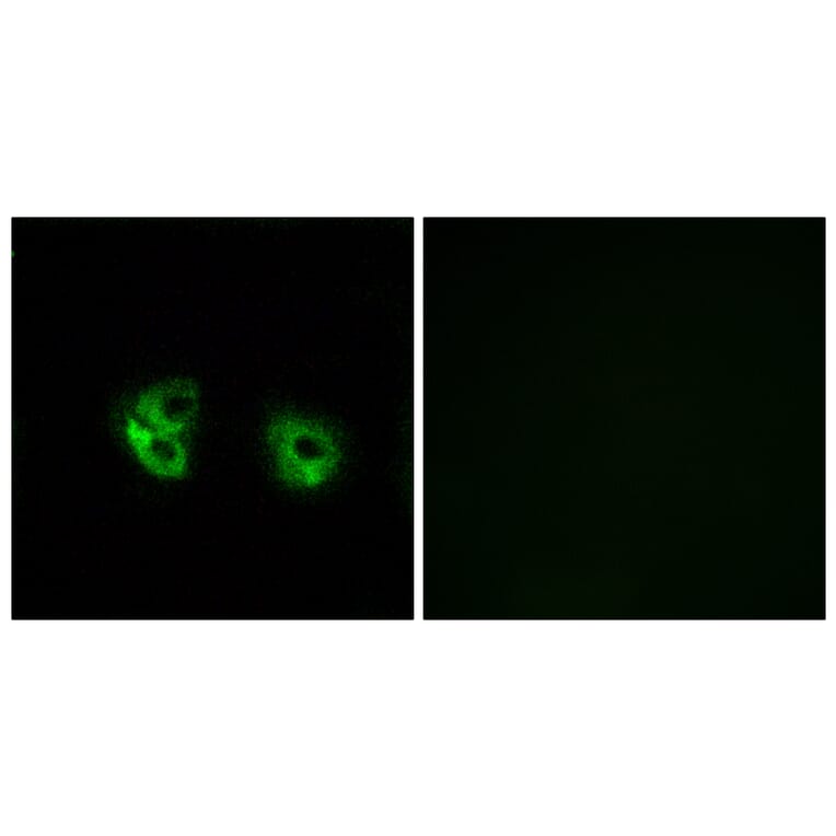 Immunofluorescence - Anti-MARCH2 Antibody (C15547) - Antibodies.com