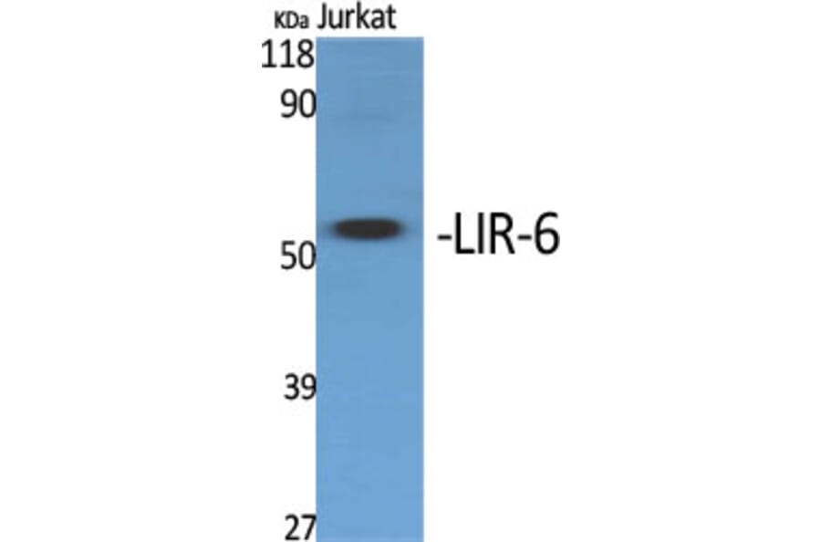 Western Blot - Anti-LILRA1 Antibody (C16461) - Antibodies.com