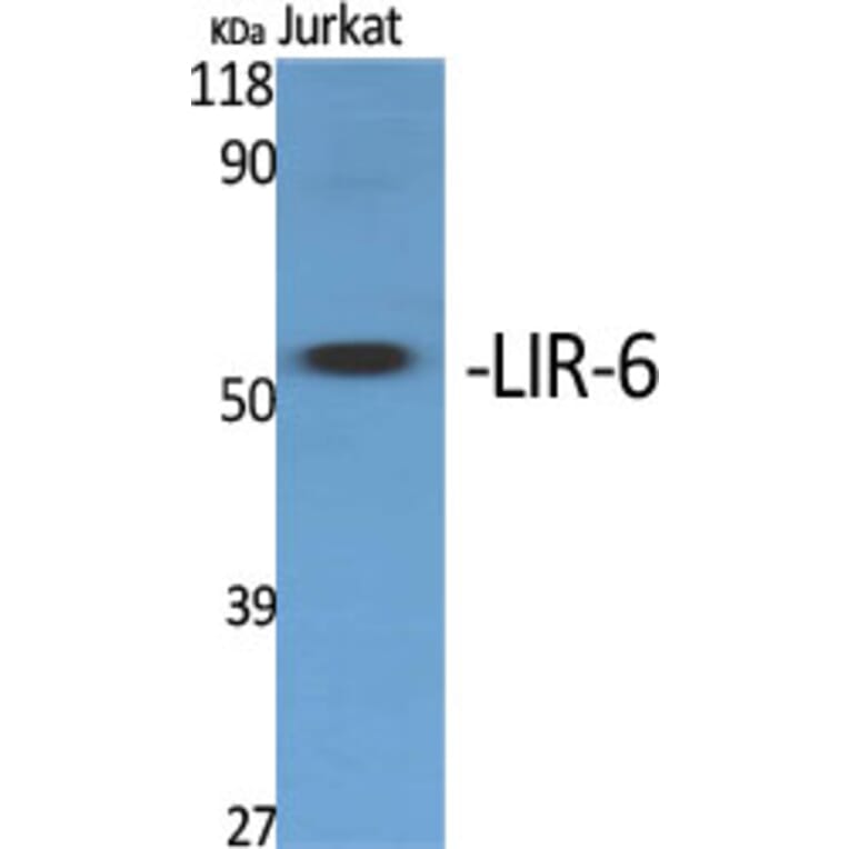 Western Blot - Anti-LILRA1 Antibody (C16461) - Antibodies.com