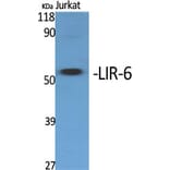 Western Blot - Anti-LILRA1 Antibody (C16461) - Antibodies.com