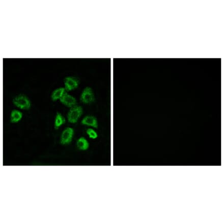 Immunofluorescence - Anti-GPRC5B Antibody (G318) - Antibodies.com