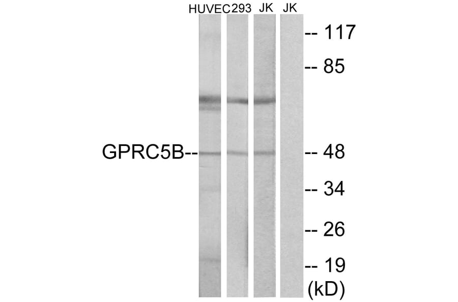 Western Blot - Anti-GPRC5B Antibody (G318) - Antibodies.com