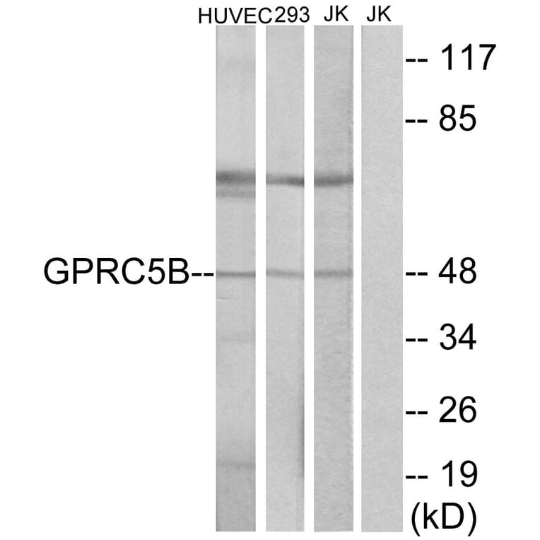 Western Blot - Anti-GPRC5B Antibody (G318) - Antibodies.com