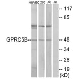 Western Blot - Anti-GPRC5B Antibody (G318) - Antibodies.com