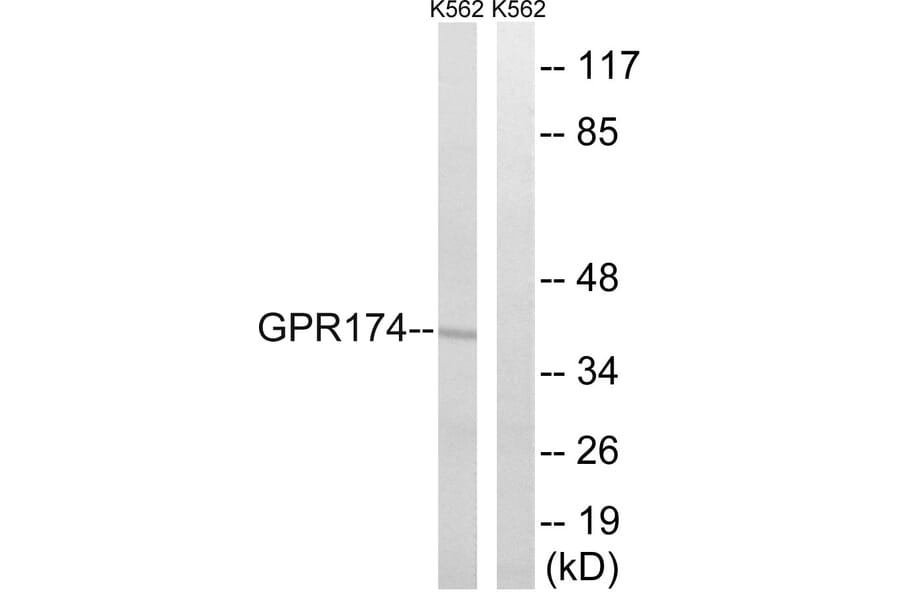 Western Blot - Anti-GPR174 Antibody (G312) - Antibodies.com
