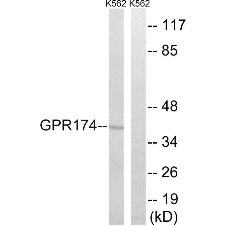 Western Blot - Anti-GPR174 Antibody (G312) - Antibodies.com