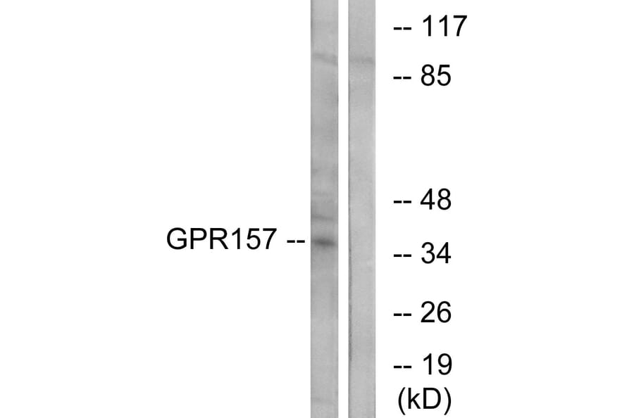 Western Blot - Anti-GPR157 Antibody (G306) - Antibodies.com