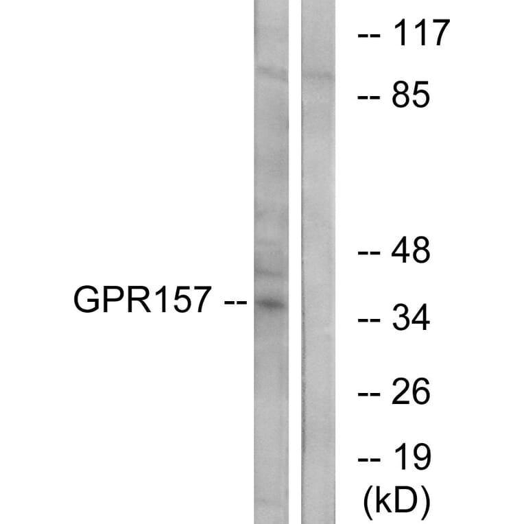 Western Blot - Anti-GPR157 Antibody (G306) - Antibodies.com