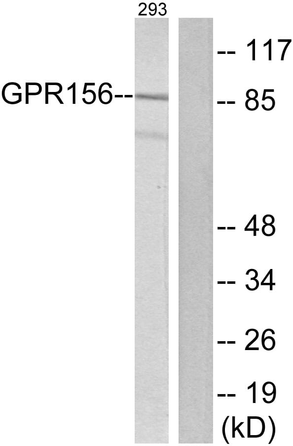 Western blot analysis of lysates from 293 cells using Anti-GPR156 Antibody. The right hand lane represents a negative control, where the antibody is blocked by the immunising peptide.