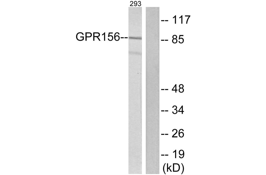 Western Blot - Anti-GPR156 Antibody (G305) - Antibodies.com