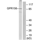 Western Blot - Anti-GPR156 Antibody (G305) - Antibodies.com