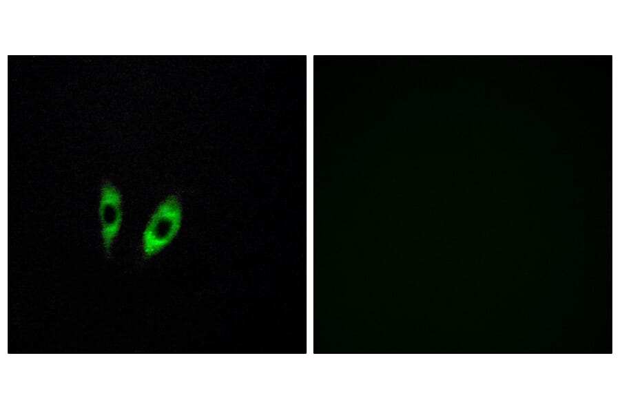 Immunofluorescence - Anti-GPR156 Antibody (G305) - Antibodies.com
