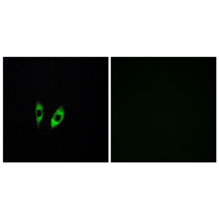 Immunofluorescence - Anti-GPR156 Antibody (G305) - Antibodies.com