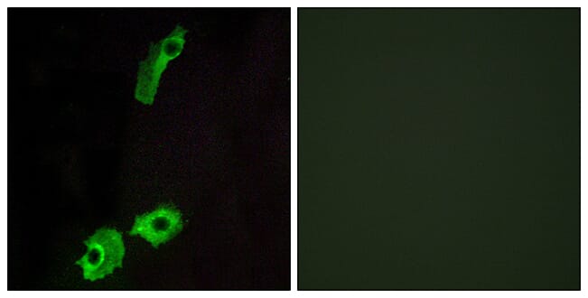 Immunofluorescence analysis of HeLa cells using Anti-GPR151 Antibody. The right hand panel represents a negative control, where the antibody was pre-incubated with the immunising peptide.
