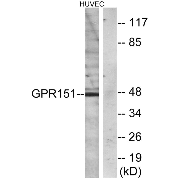 Western Blot - Anti-GPR151 Antibody (G137) - Antibodies.com