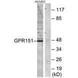 Western Blot - Anti-GPR151 Antibody (G137) - Antibodies.com